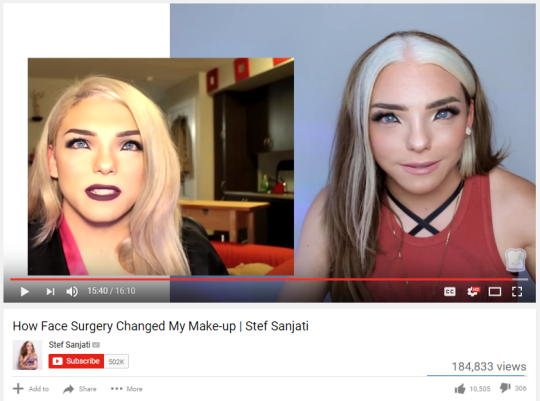 toocooltobehipster:  lindsaychrist: lindsaychrist:  stef sanjati got ffs nearly completely free with crowd funding (i think she got 35k from donations) and no shade it looks like she just got her chin/jaw shaved down 3mm (at most omg) like why did it