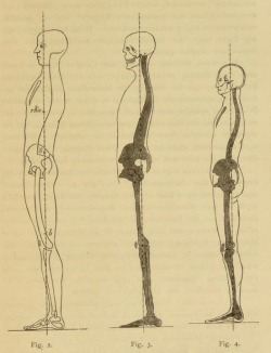 nemfrog:  Examples of normal posture. Figure