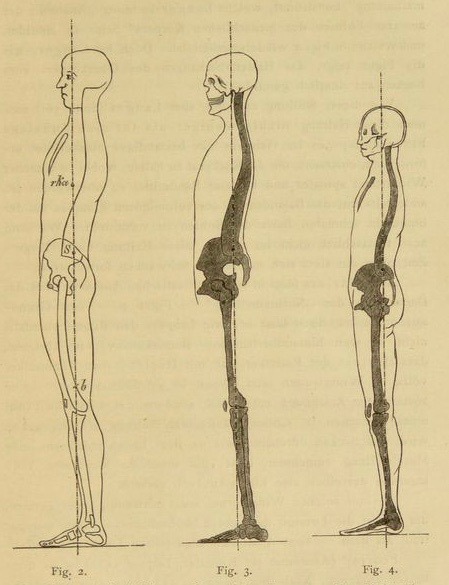 nemfrog:  Examples of normal posture. Figure on the left is an example of military posture. Die menschlichen Haltungstypen und ihre Beziehungen zu den Rückgrat verkrümmungen. 1889.  