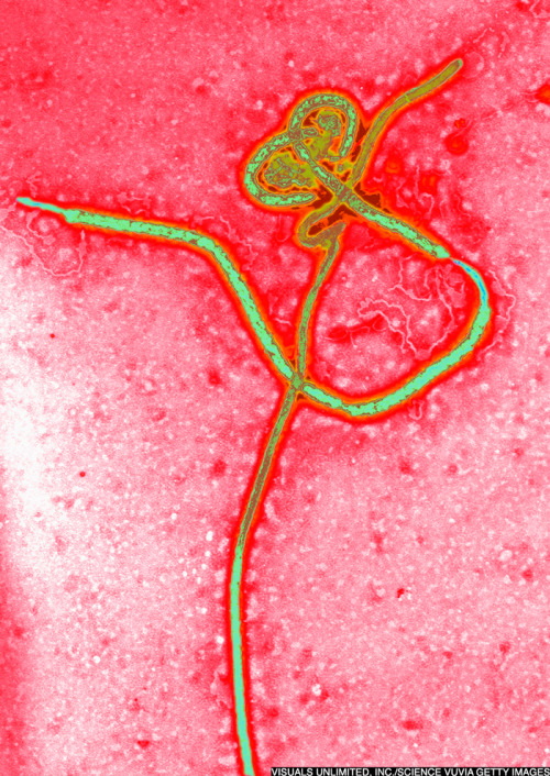 huffingtonpost:  Health Officials Say Up To 100 People May Have Been Exposed To Texas Ebola Patient DALLAS, Oct 2 (Reuters) - Up to 100 people may have had direct or indirect contact with the first person to be diagnosed with the deadly Ebola virus in