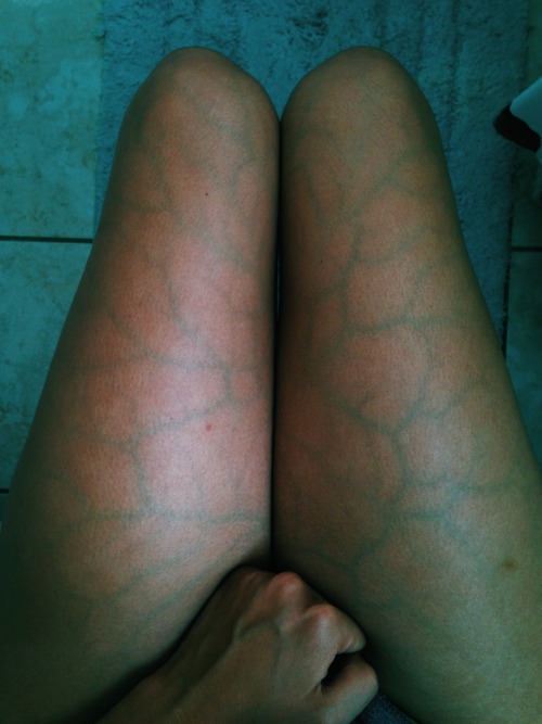 clcuds: thinned-skin: Yesterday I took a photo of my legs using vscocam. I used the preset C1 and st