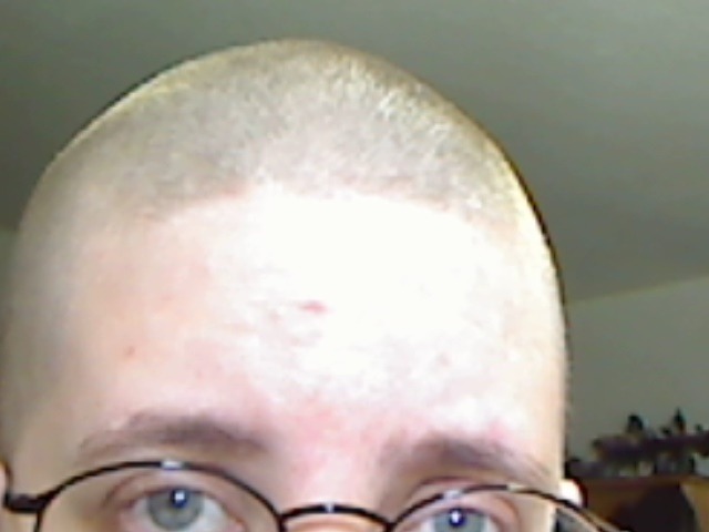 The guard on the clippers slipped. I was supposed to still have hair &hellip;