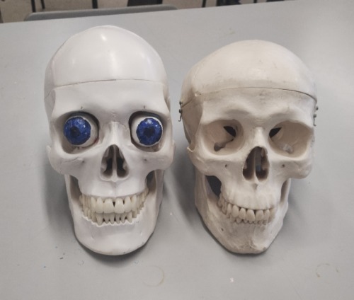 Photo of two anatomical skulls facing the camera the one on the left is a brighter white and slightly taller, the right one is grubbier looking. The left skull has fake eyes with blue irises stuck into its eye sockets.