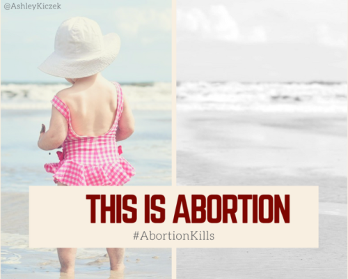 This is Abortion: Abortion destroys a Future. #Abortionkills #prolife