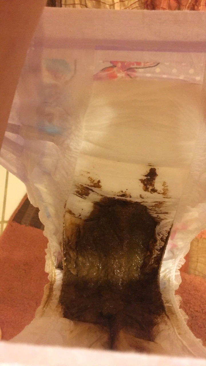 diapergirl-wetandmess:  Here are the messing pictures! It was quite the relief as