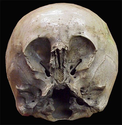 Porn The Starchild Skull DNA proves it is not photos