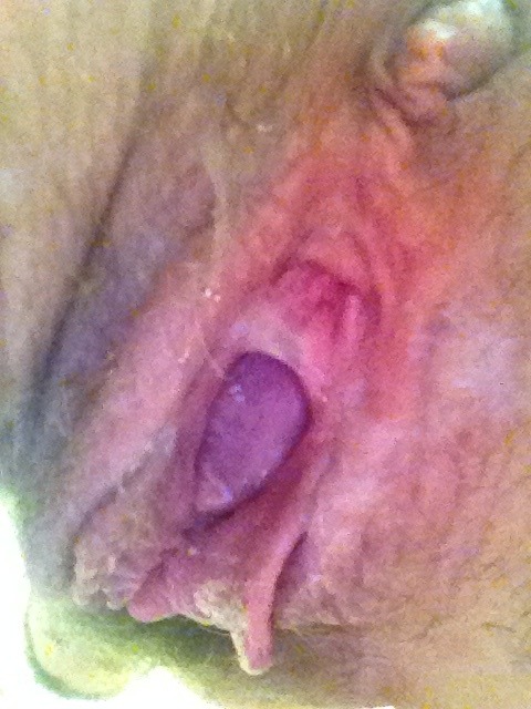 mysluttyusedpussy:  Here is a recent pic of my slutty pussy after I’ve been freshly