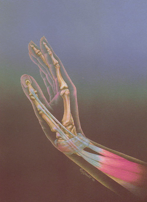 ∞