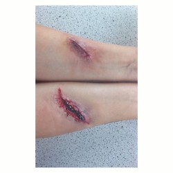 nonelikerae:  Another day in the office. @nadiya_jay   #me #makeup #mua #sfx #specialeffects #cuts #bruises #ouch #gore #blood