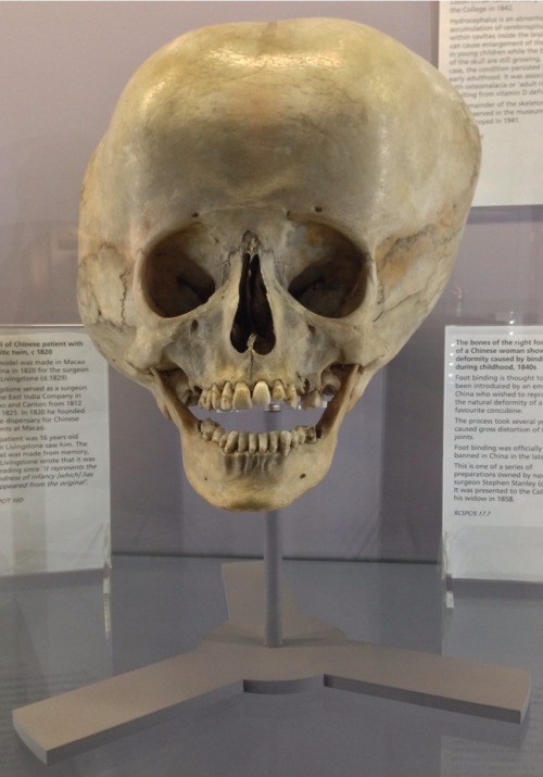 crookedindifference:  I spent the afternoon at the Hunterian Museum in London. 