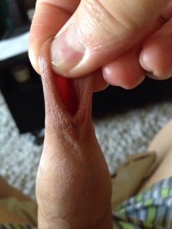 seankimcheese:  Stretchy foreskin!