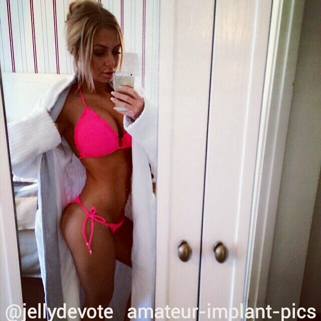 amateur-implant-pics:  @jellydevote