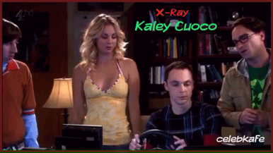 yojanarmando:  X-RAY