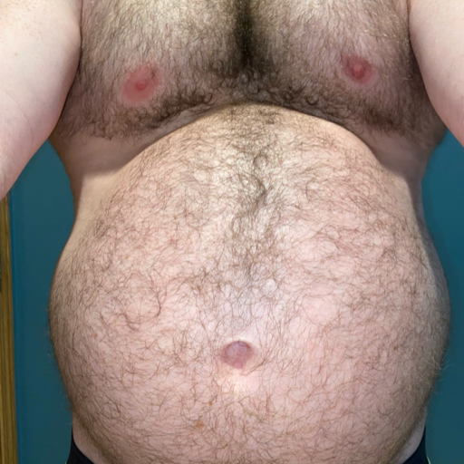 bigbellyboiz:peludosconcamisa-deactivated202:Such a great belly.