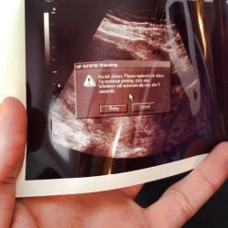 cisphobequeen:  stunningpicture:  This is the first picture I was given of my unborn son  congrats, ma’am. It’s a Printer Error. 