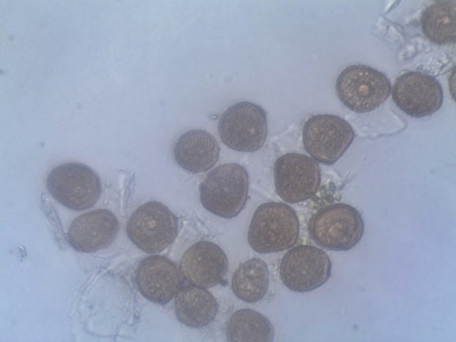 Puccinia taraxaci -rust fungus producing urediospores on dandelion (Taraxacum officinale)