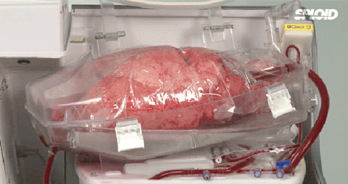 Porn Pics How a human lung is kept alive and breathing