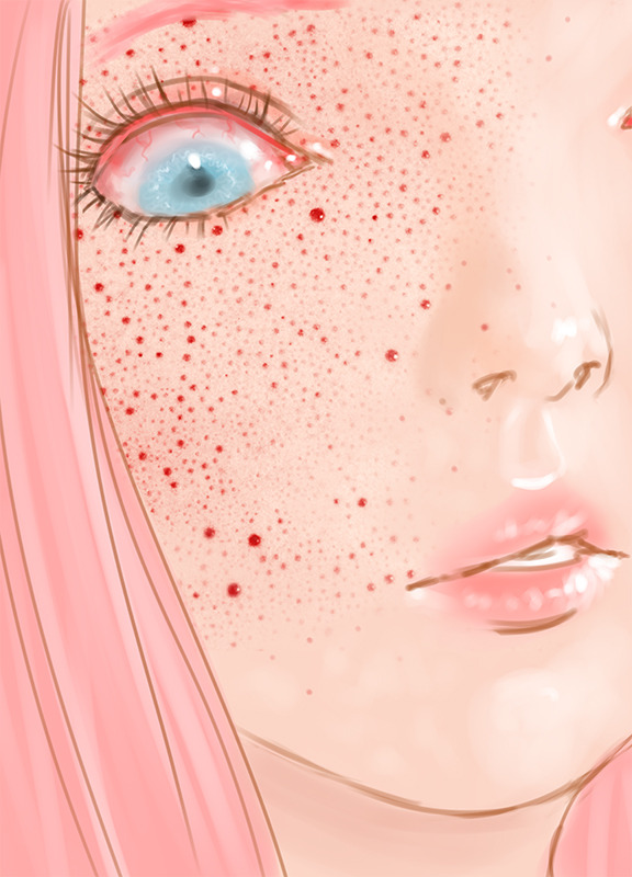 saccstry:  A while ago I edited a pic of my frosty to look like bloody skin pores.