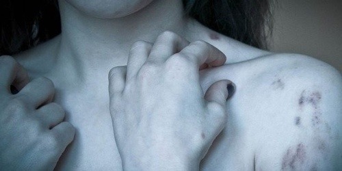 http://x014.tumblr.com/post/115642331229