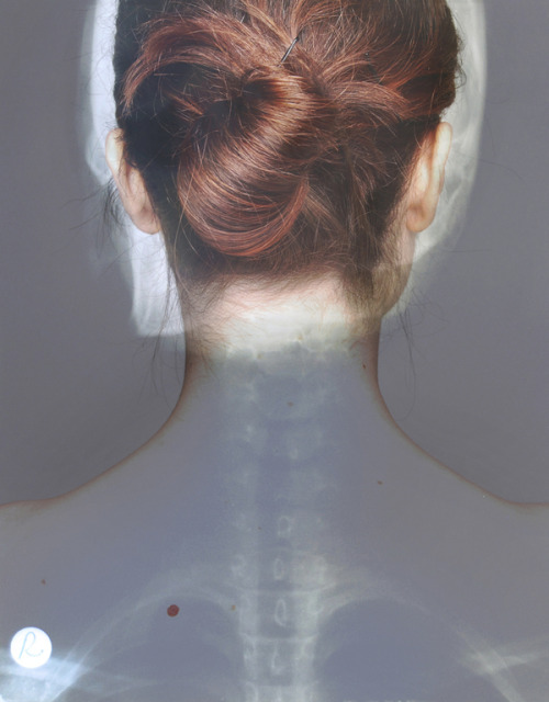 myampgoesto11: Inside-Outside: X-ray self portrait series by Dilek Öztürk &ldquo;