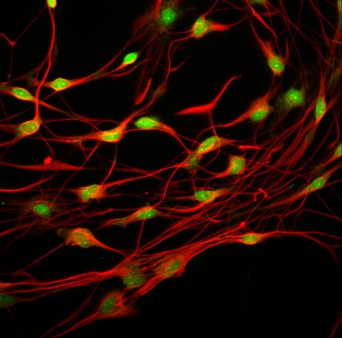 Rat dorsal root ganglia cells stained for Alpha Acetyl tubulin (red) and Nissl bodies (green).