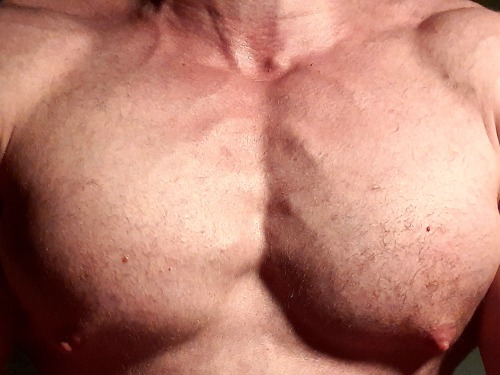 Side Effects: Gyno & Lactation