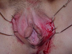 pussymodsgalore  BDSM. Hooked outer labia