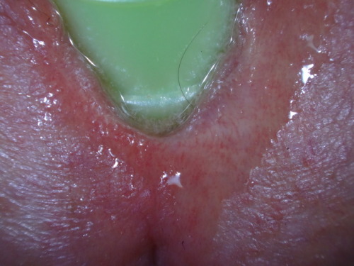 largefloater:Juices flowing