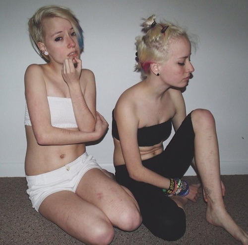 crash-your-life:  Self-Harm scars on We Heart Ithttp://weheartit.com/entry/112234006/via/RyahanKrug