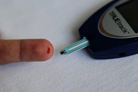 High Blood Sugar Linked to Dementia People with diabetes face an increased risk of Alzheimer’s