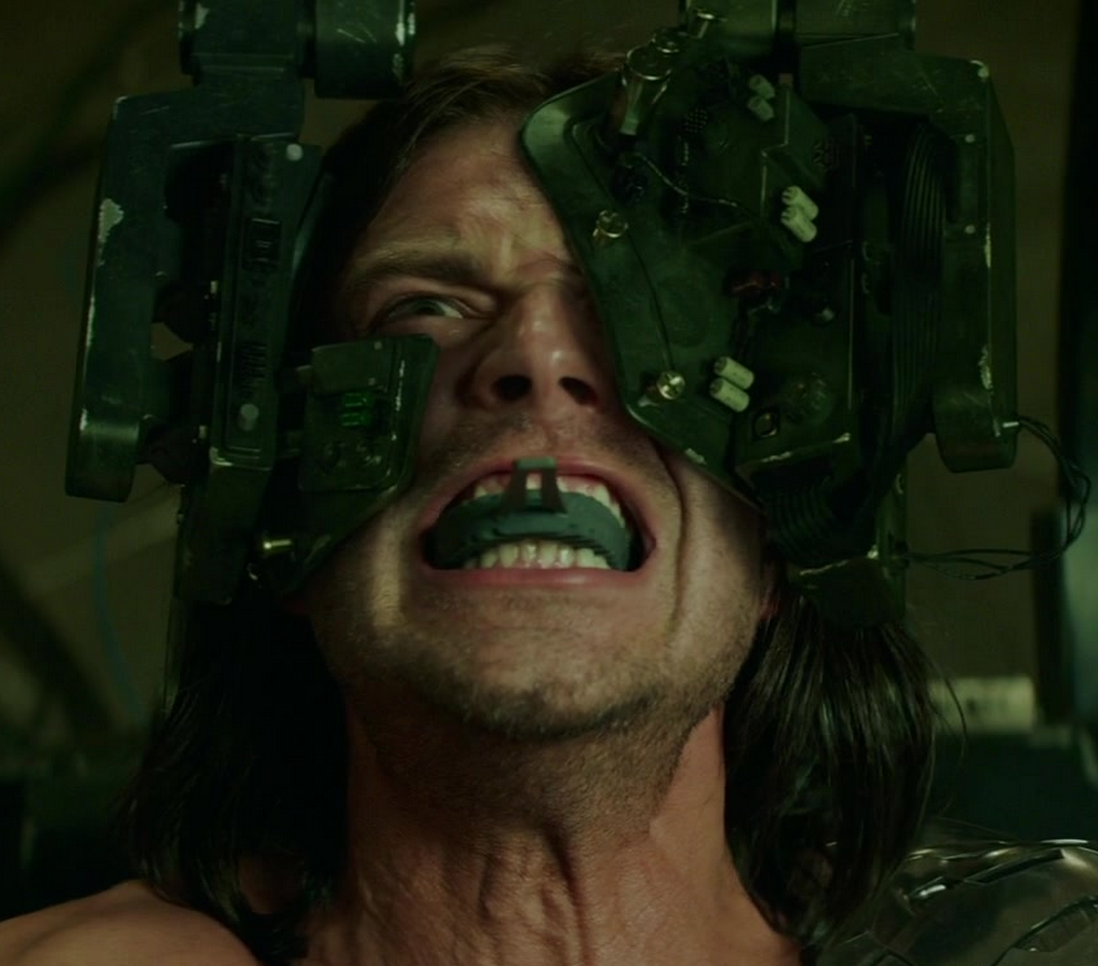 wolfpawn:  too-many-fandoms-in-one-mind:  weinersoldier:  I KNEW these bruises on