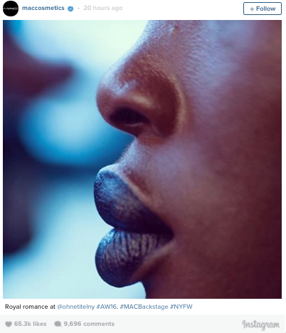 gurl:  Admit It: You Only Like Big Lips When They’re Not On Black PeopleBlack women