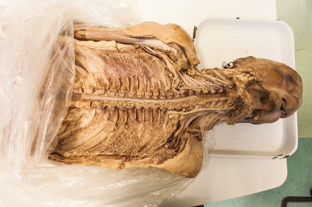 flyonthewallmedstudent:  forensicimagination:  (via What Happens When You Donate