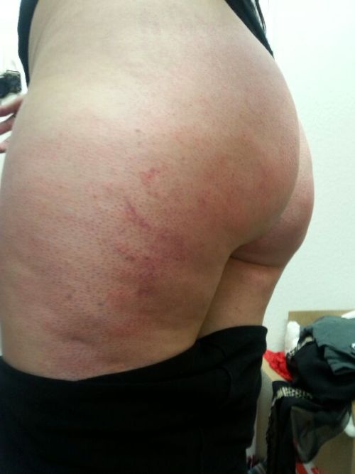 creepygirlmouse:  Shit quality pic but I GOT SPANKINGS YAY  Also, learned all about CBT tonight from a well-respected community member… so awesome!