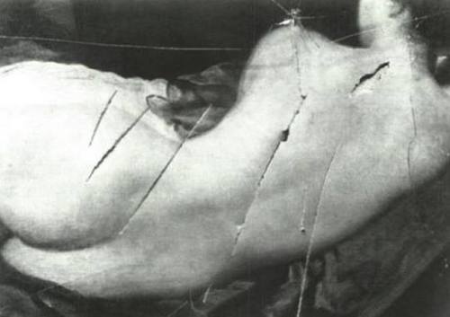 ledoshumain:  Venus at her Mirror, 1647-51(detail), Diego Vélasquez  (damage sustained in the attack by the suffragette Mary Richardson in 1914) 
