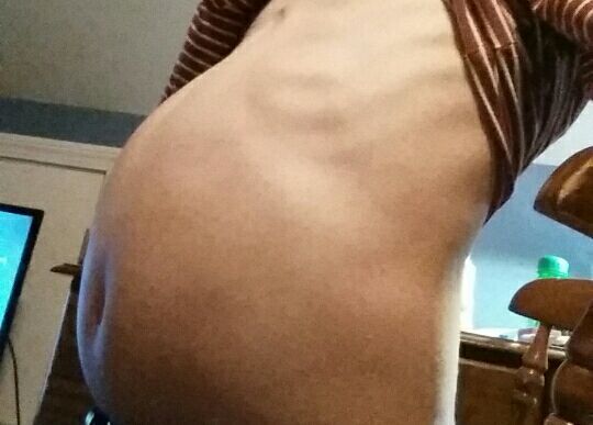 skinnybellyblimp:  Ffffffffff I need to stop eating so much, my stomach was stretched