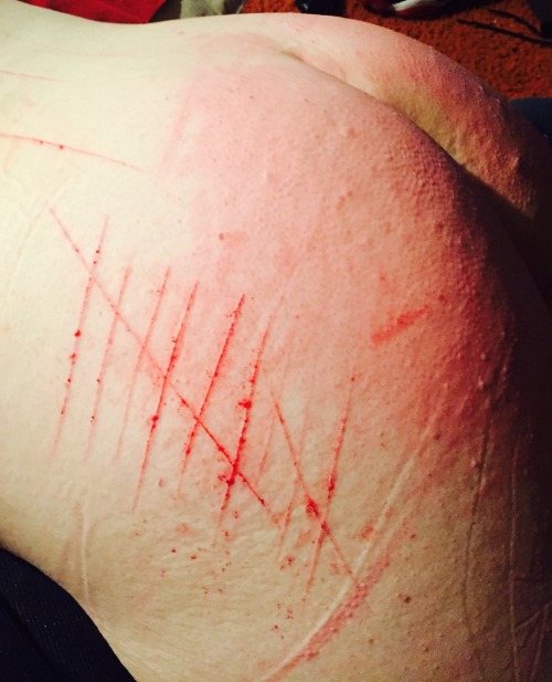 baabycunt2:  another-nail-in-my-coffin:  aliglaz:  bruisedmmmmuse:  sick-young-man:  This girl got play time with daddy today. For every 10 swats of the cane she took without squirming or running away she received a mark to remind her. I’m so proud