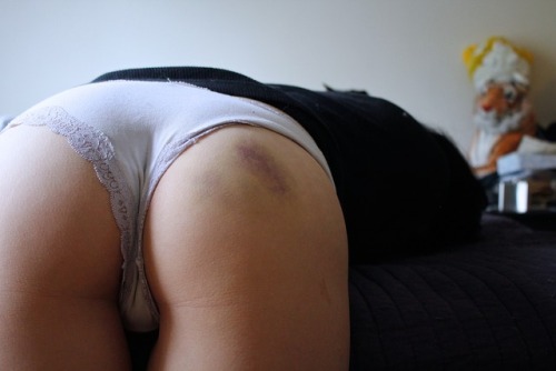 untamed-kitten: Bad little baby with a bruised bumspoil me  |  ask how to buy my snapchat  |  more o