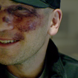 frankcastles:he is beauty, he is grace; he is mr bruised-up face 