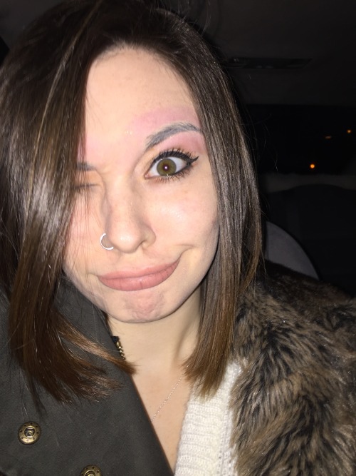 circussing:  When you just got your brows done and have to go to the mall looking like a brow burnt lobster