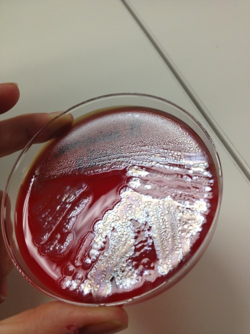Pseudomonas Aeruginosa On Sheep Blood Agar.