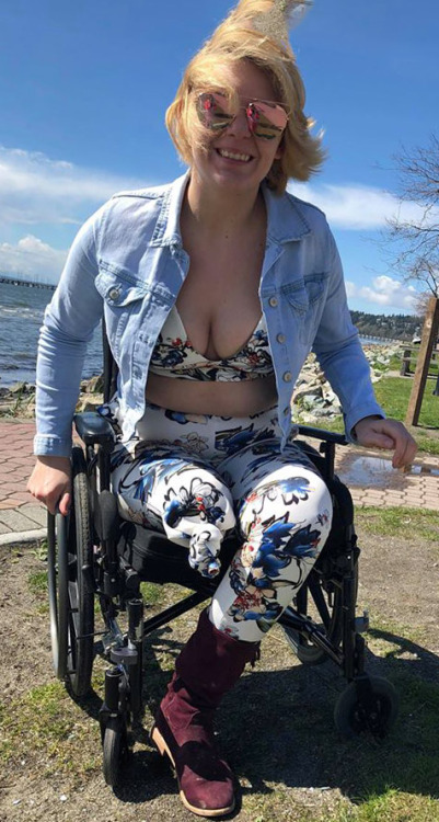 RAK amputee with tied off pant leg in wheelchair wearing bikini top
