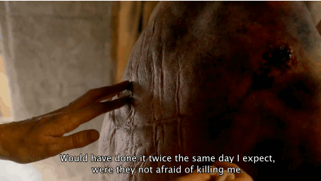 Porn Pics  Jamie Fraser’s Scars  There's no joy in