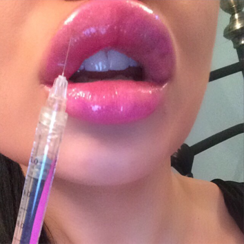 mistydoll: darkersideofthestone: The New Average Ok 2 things.Is she injecting her own lips?Is that a