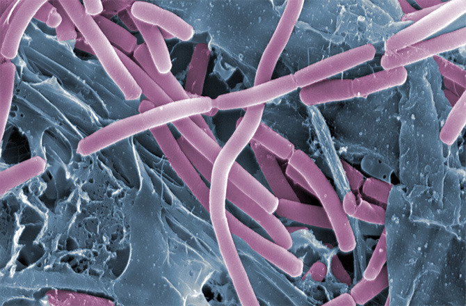 discoverynews:  These Bacteria Could Live in Europa’s OceanThe idea of life existing