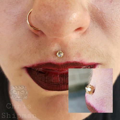 Healed philtrum by me upgraded to an 18k yellow gold Queen end with a reverse set CZ and a healed no