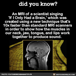 did-you-kno:  An MRI of a scientist singing ‘If I Only Had a Brain.’ Source 