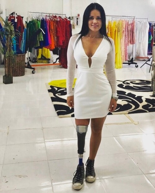 an amputee girl in the dress store