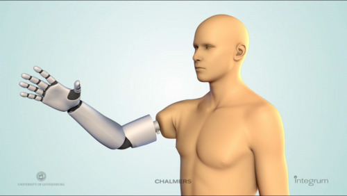 neurosciencestuff:World premiere of muscle and nerve controlled arm prosthesisFor the first time an 