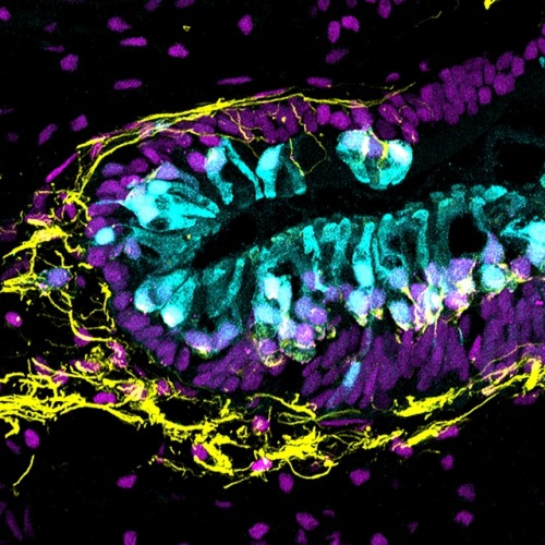 (Image caption: Human inner ear organoid with sensory hair cells (cyan) and sensory neurons (yellow)